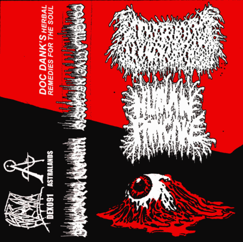 Human Pancake : Coagulative Necrosis - Human Pancake